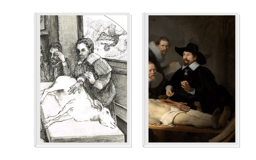 Left: detail showing a figure inspired by Rembrandt's painting. Right: detail from Rembrandt 'The Anatomy Lesson of Dr Nicolaes Tulp' (image from Mauritshuis)
